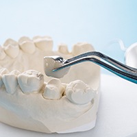 a wax model with dental crown in Mesquite illustrating benefits