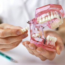 Implant dentist in Mesquite holding bridge and model containing implants