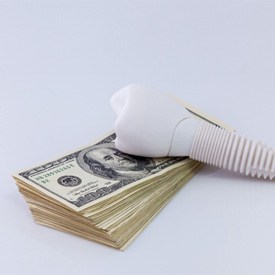 large model of a dental implant resting on top of a stack of money  