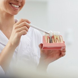 Mesquite implant dentist holding a model of dental implants for patient 