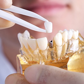 Dentures And Implants Mesquite Tx  . Single Implants, Implant Supported Restorations, Full Mouth Implants, Dental Implants Prices, Promotions For Dental Implants In Cancun Mexico 2020.