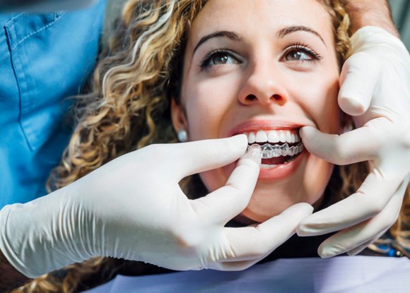 Straighten your smile quickly and easily with Invisalign near Sunnyvale 