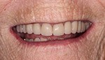 Closeup of healthy natural looking smile