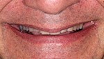 Closeup of damaged uneven smile