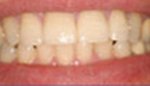 Closeup of bright white healhty smile