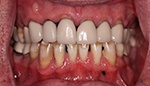 Closeup of damaged uneven smile