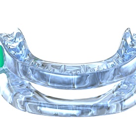 a close-up of a sleep apnea oral appliance  