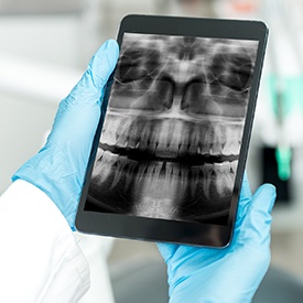 Digital x-rays on tablet computer