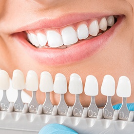 Smile compared with color chart