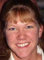 Woman's smile with yellow unevenly spaced teeth