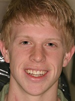 Young man with large front teeth