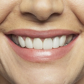 Closeup of flawless healthy smile