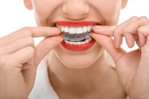 Straighten your teeth with Invisalign in Mesquite. 