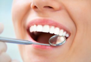 woman smiling teeth examination