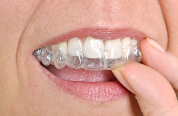 woman wearing clear dental aligners