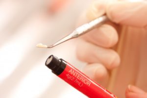 dentist holding a tube of composite resin