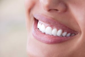 Smiling woman with beautiful, improved teeth