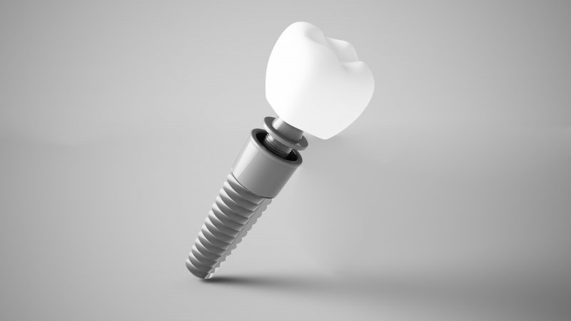 Dental implants